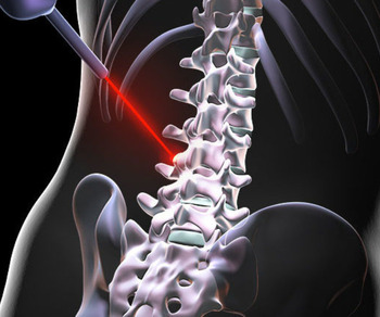 Spine Laser Treatment Facilities, HealthPoint Hospital