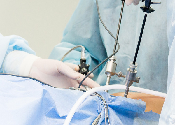 Laparoscopic Surgery