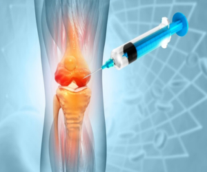 Regenerative Orthopaedics